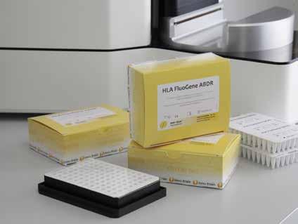 Fördelar: PCR-SSP metod utan gelelektrofores inom 90 minuter Inga hybridiserings- eller tvättsteg Resultat förevisas direkt efter läsning Ingen risk för post-pcr kontaminering Låg koncentration av