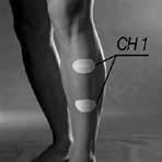 Öka styrkan i tibialis anterior samt i peroneus longus och brevis. 2. Minska spasticiteten. 3.