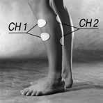 dorsalflexion. 1. Öka den plantara och dorsala rörligheten i foten. 2.