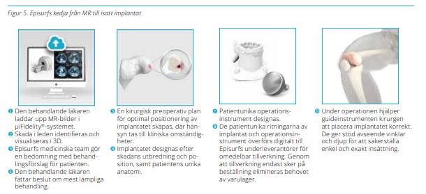 Episealer -implantatsystemet för knän innefattar av följande: 1. Knäimplantaten Episealer 2. Episealer verktygskit 3.