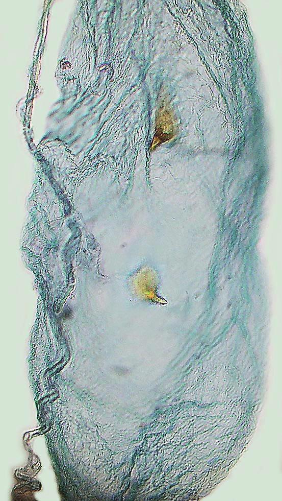 The sterigma in the ostium area is reminding of a wineglass. Slide BÅB 2057X. c) C. pulchrimella. Corpus bursae with small signa. Slide BÅB 2057X. Photo: Bengt Å. Bengtsson. som årligen.