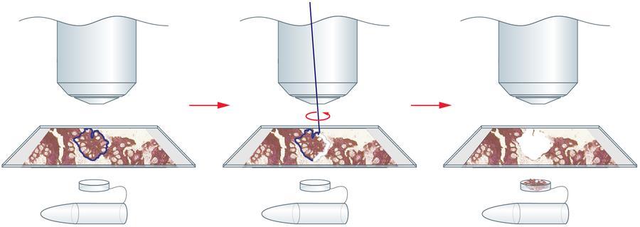 Metod Anrikning av Helicobacter pylori