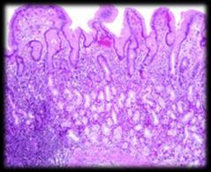 cancer Normal Gastric