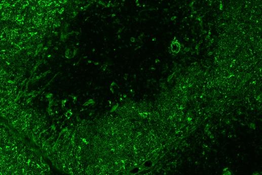 Paper II: Thymic B cells Thymic B cells have also been proposed to play a role both in the induction of T regulatory cells 91, 92 and in the deletion of autoreactive thymocytes in an experimental