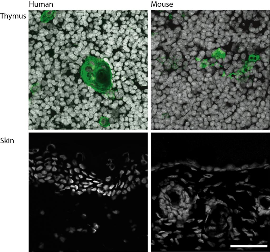 Paper III: Hassall s corpuscles One potential function of the Hassall s corpuscles could simply be to provide skin specific antigens for T cell education.