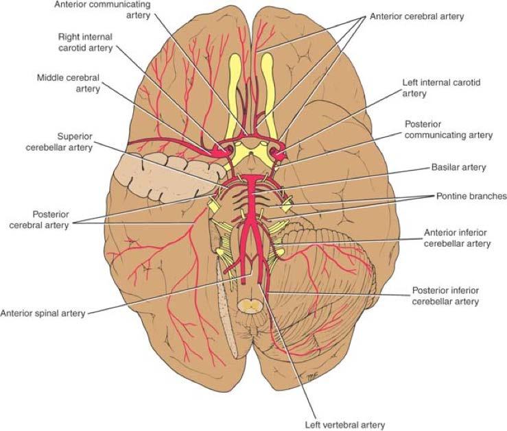 Men proppar i hjärnans stora kärl svarar dåligt på trombolys a cerebri media a cerebri anterior a carotis interna a basilaris 10% av alla