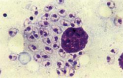 Leishmania-amastigoter intracellulärt i makrofag.