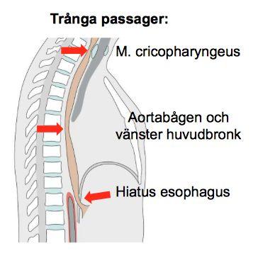 Spottkörtlar: Glandula parotidea (kinden), glandula sublingualis (under tungan), glandula submandibularis (under käken). Facialis nerven (VII) går genom parotidea. Ductus parotideus.