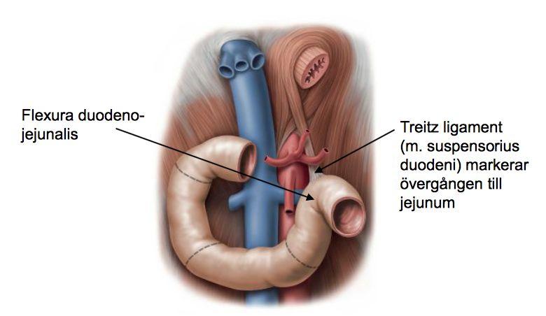 Esophagus varicier (fel i levern med blodflöde, blödning i cardia.