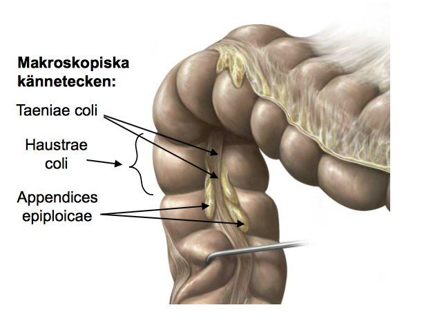 Redogöra för tjocktarmens olika delar, deras morfologiska karaktäristika och principiella kärl- och nervförsörjning Övergången Ileum tjocktarmen