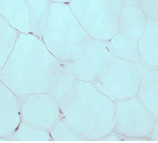 Fettvävnad Klargöra utseendemässiga skillnader mellan vita (unilokulärt fett) och bruna (multilokulärt fett) fettceller (S1-S2) Fettvävnad: -Vit fettcell (fettet ligger unilokulärt) en stor fettdropp