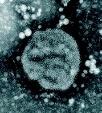 Hongkong-influensa drabbade landet under vintermånaderna 1969 [5, 59-61]. En andra, kraftigare pandemivåg svepte över landet vid årsskiftet 1969 1970 [5].