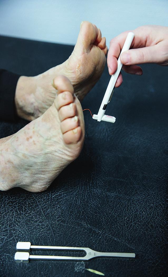 Pyssla om foten Diabetes kan ge nervskador och dålig blodcirkulation i fötterna. Nedsatt känsel gör att sår inte alltid känns.