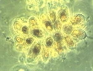 WP4.2 Phytoplankton enkätundersökning (nej) Problem a; bedöma om höga zooplanktontätheter. Tiear vi inte extra på i deea projekt. Kostnader för analyser är höga. Kommer vi inte göra något åt.