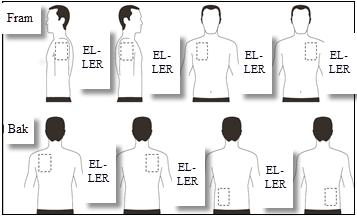 vänster eller höger sida av övre delen av ryggen vänster eller höger sida av nedre delen av ryggen Ta av föregående dags plåster efter 24 timmar innan ETT nytt plåster sätts på ENDAST ETT av följande