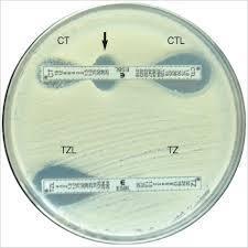 Antalet konstaterade fall av ESBL-producerande Enterobacteriaceae (fr a E coli och Klebsiella pneumoniae) ökar i jämn takt och nästan fyrdubblats sedan 7. Jämfört med 1 en viss ökning.