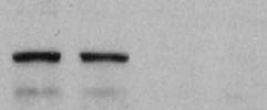 EX3 EX4 allele - allele EX2 LoxP