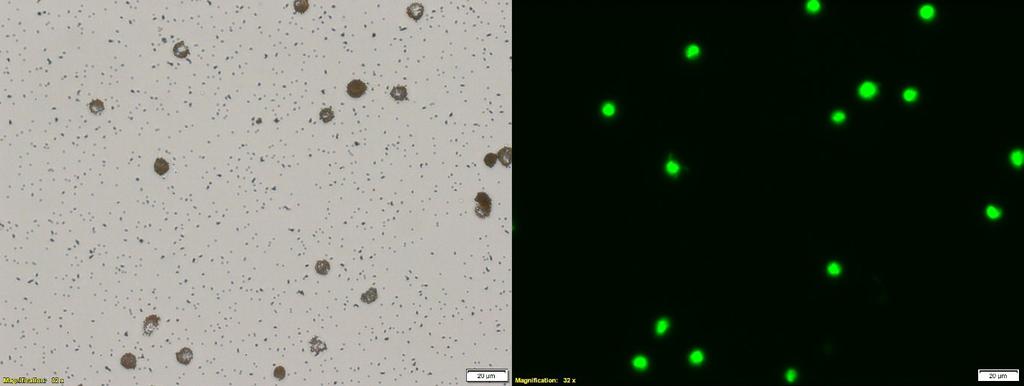 Supplementary Figure 2: Bright field and fluorescent micrographs of