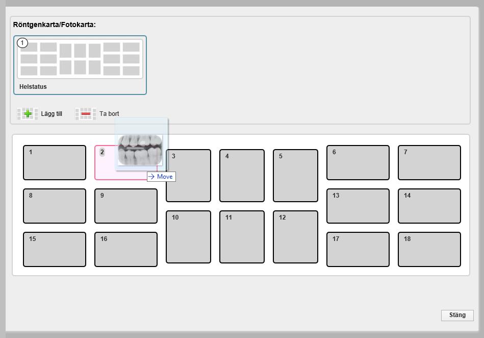 När man valt röntgenkarta/fotokarta kan man antingen (som bilden nedan visar) dra en bild till rutan där