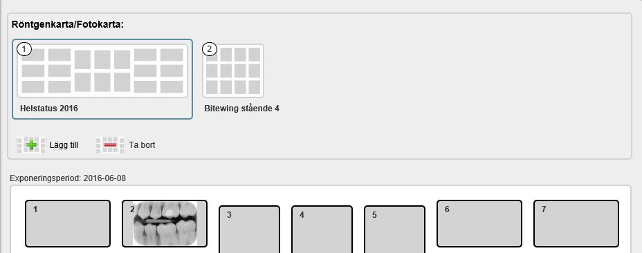 34 (35) Genom att klicka på bilden med plustecknet kan man välja att lägga till flera röntgenkartor/fotokartor.