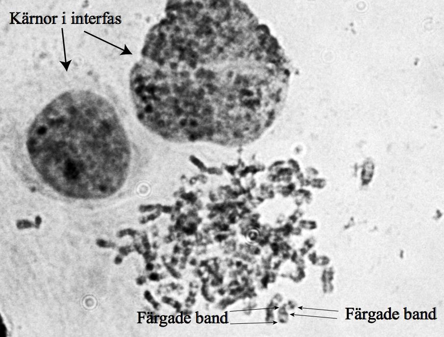 Figur 4. I figuren visas G-bandsfärgning av VMM1-celler odlade till 80 % konfluens.