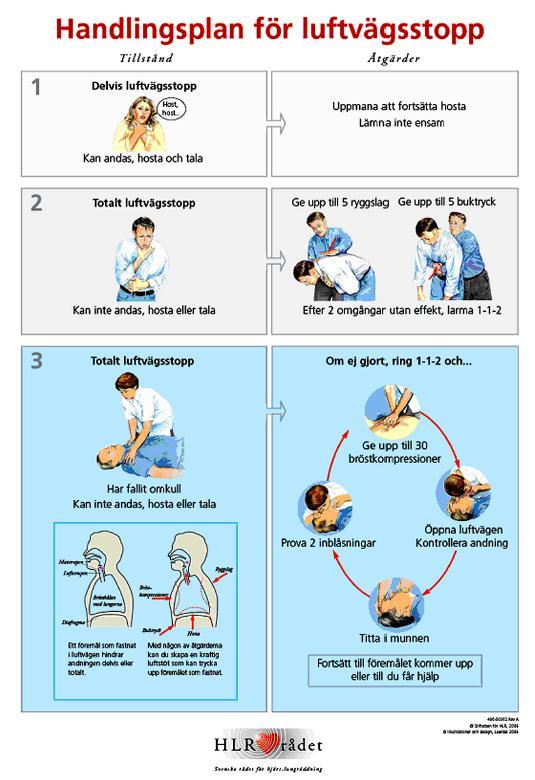 A- Airway Om patienten är vaken eller andas börjar man bedöma B. Ruska i den som är medvetslös (var dock försiktig om du misstänker att patienten har en rygg/nackskada).