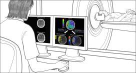 SCAN DIAGNOSIS FIRST TRIAGE NOTIFCIATION TPA