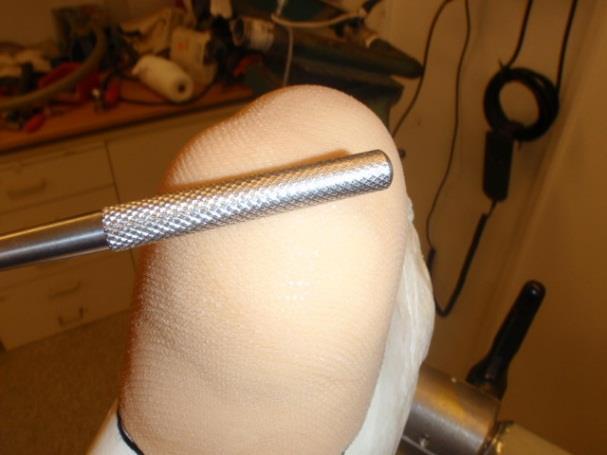 Pilla försiktigt bort nylonstrumpan/ perlontrikån runt silikon kanten.