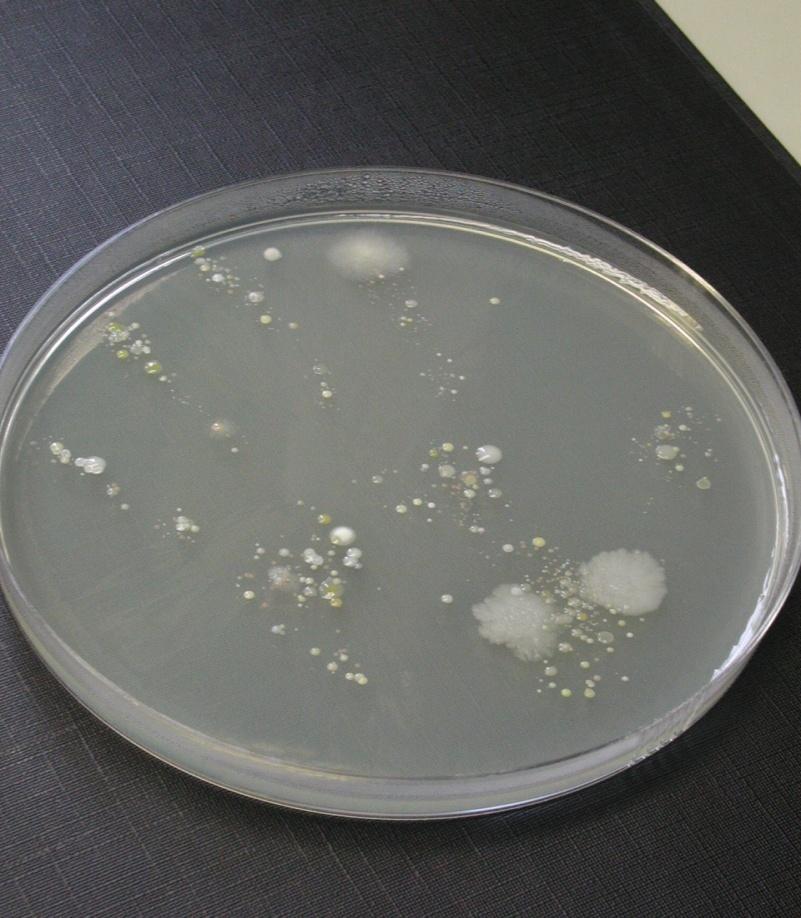 11 Personlig hygien är viktigt! Foto: Mikrobiella kolonier på fast medium.