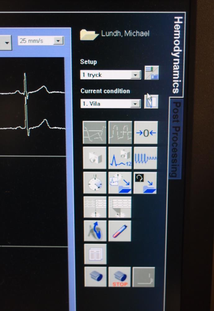 Registrering av blodtryck, pox och artärtryck i Axiomsensis lab 1 och lab 3 vid Angio/PCI 1. Högst upp till hö på skärmen vid arbetsstationen Välj under Setup: 1 tryck (oftast förvalt) 2.