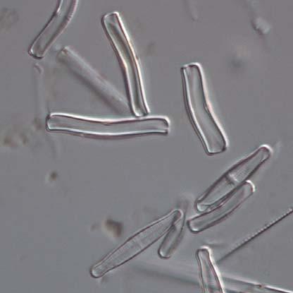 placentula och artgruppen Achnanthidium