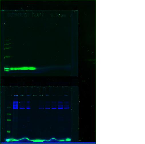 Right image: Detection using Coomassie stain.