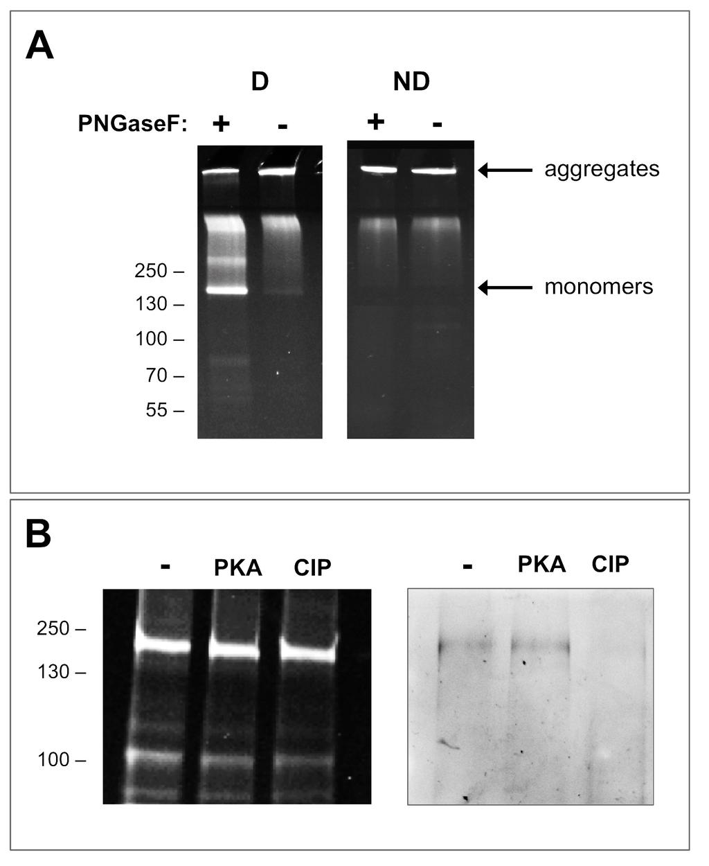 Supplementary Figure 3: Left panel: CFTR expressed in yeast and purified in DDM was treated with no enzyme (-) or protein kinase A and ATP (PKA) or alkaline phosphatase (CIP) at 4 C overnight and