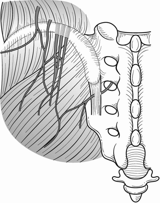 N obturatorius L2-L3 Adduktor-gruppen Lesion