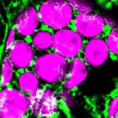 nalysis of organelle targeting signals on LS.