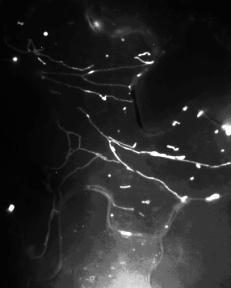 Peroxisomes (YFP-PTS1) WT drp3-2 drp3-2 drp3-2