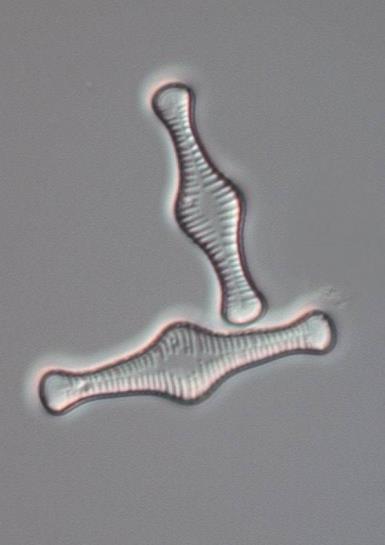 minutissimum (Figur 4), dominerade ( 70 %) kiselalgsamhället på dessa lokaler. Achnanthidium minutissimum är en av de vanligaste kiselalgerna i många rinnande vatten (förutom i de riktigt sura).