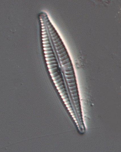 Exempel på arter som föredrar näringsfattiga vatten och som förekom på en eller flera lokaler i undersökningen är: Brachysira neoexilis (se framsida), Cymbella excisiformis, Denticula tenuis,