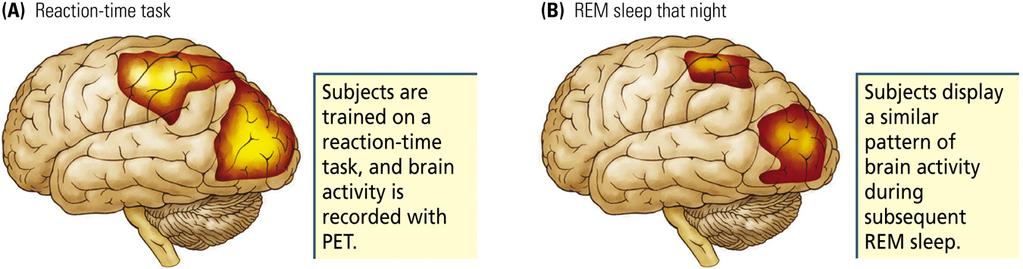 neurodegenerativa sjukdomar som främst drabbar äldre. Sömn som minnesförstärkning?