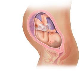 Handläggning Välbehandlad IBD vid konception Vid bukbesvär under graviditeten uteslut annan genes (förstoppning, reflux, gastroenterit, gallsten allt är inte IBD!