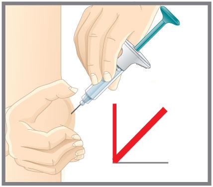 Injicera INTE på precis samma ställe varje gång. Om du t.ex. gav den första injektionen i magen kan du ge nästa i ett annat område av magen. Tvätta och torka injektionsstället innan du injicerar.