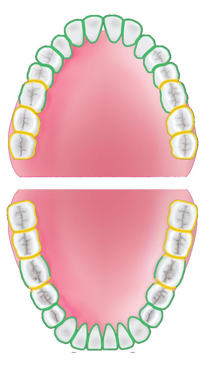 tandsten i premolar- och molarområden - För alla tandytor - Mini-modellen är