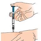 4 Nyp försiktigt ihop huden runt det desinficerade injektionsstället (för att lyfta upp det lite). 5 Håll sprutan som en penna eller en pil.