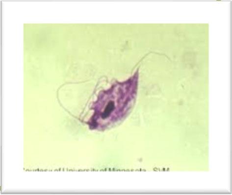 Tritrichomonas Foetus Förekommer hos alla katter Relativt ny encellig parasit hos katt Smittar