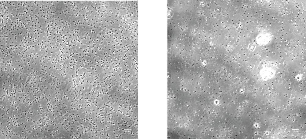 372 LEWIS et al. (a) i. BL21DE3 mm IPTG ii. BL21DE3 1 mm IPTG DL49_DL49Q_DL49Q.1.fcs iii. Total Cells 1 Uninduced iv. Overton Aggregated Subtraction Cells 1.5% 1 1 1 1 1 1 1 4 1 1 5 1 (b) i.