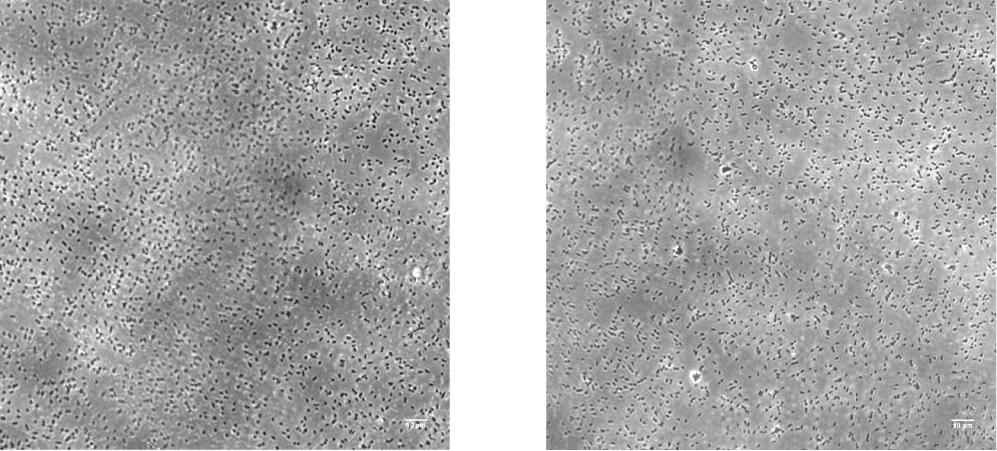 9% 1 1 1 1 1 1 1 1 1 1 1 5 1 1 FIGURE 2. Optical microscopy and flow cytometry analysis of adhesin-based bacterial aggregation.