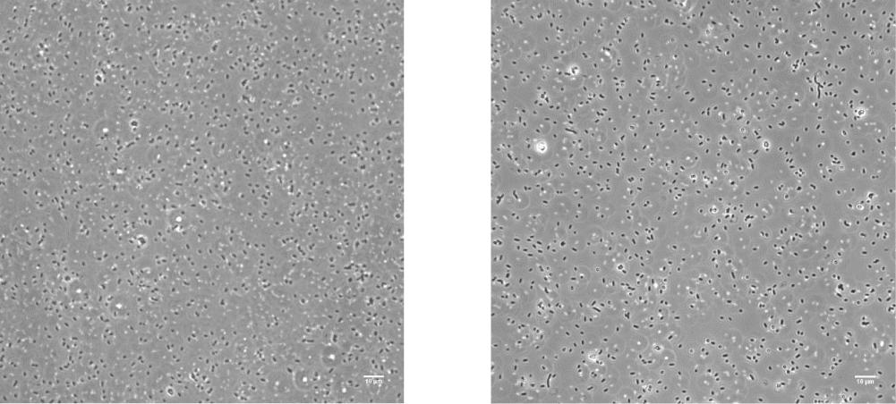 (c, d) BL21DE3 cells expressing ecpx-cohesin-ac or ecpx-dockerin-ac show large clumps (indicated by red circles in panel ii) in cultures that appear to be composed of particles the size of planktonic