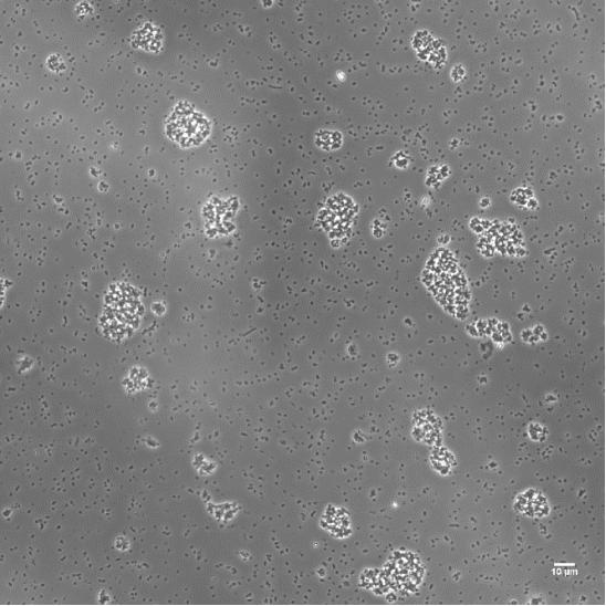 Image shows that bacterial aggregates do not have autofluorescence on this fluorescent channel.