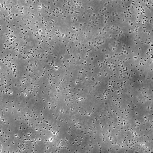 (b) 8 Aggregate 4 2 * µg/ml Proteinase K.1 µg/ml Proteinase K FIGURE 4. Dissociation of bacterial aggregates by proteinase K treatment.