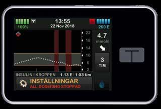 Basal-IQ med Dexcom G6 Förutser Pausar Återupptar samarbete Tandem t:slim X2 är den enda insulinpumpen som är integrerad med CGM-systemet Dexcom G6.